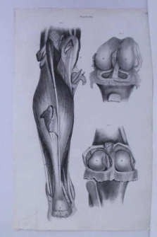 ENGRAVED FROM A DISSECTION MADE BY THE HANDS OF SIR ASTLEY COOPER (Tema: Medicina)